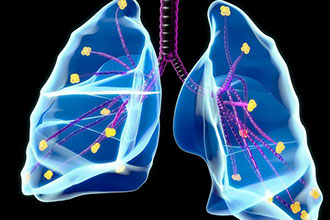 如何养肺防癌？来听听名医的“养肺箴言”